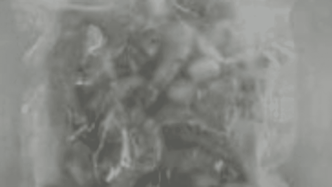 Camarón Radioactivo Importado Expone Falla Global y Peligro