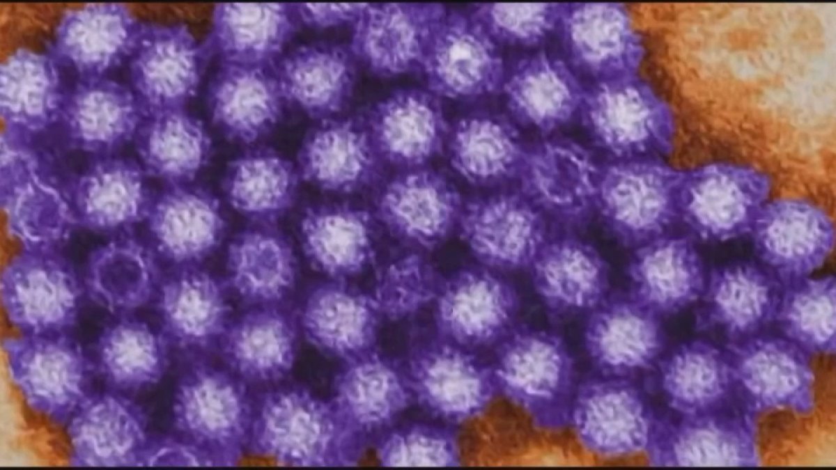 La Verdad Oculta del Norovirus: Autoridades Minimizan el Riesgo